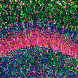 Hippocampus Brain Tissue by Science Photo Library